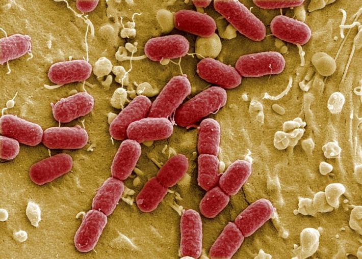 A bactéria Escherichia coli, que habita o intestino humano, ganhou um novo “design” genético Foto: REUTERS/Manfred Rohde/Helmholtz-Zentrum fr Infektionsforschung